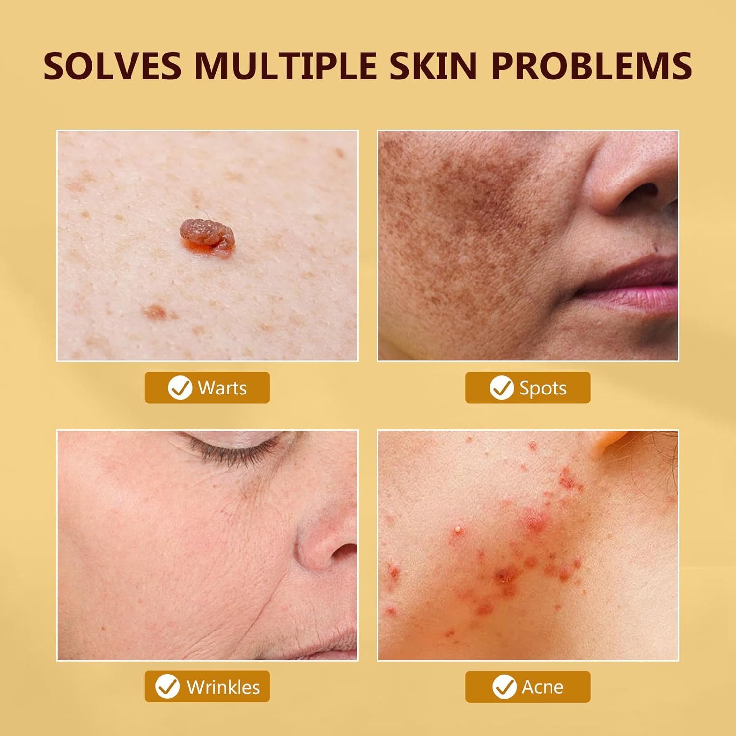 Bee Venom Skin Treatment Cream, Face Lifting & Firming Treatment to Reduce Wrinkles and Blemishes - Nourishing, Non-Irritating Restoration Cream, 2 Fl Oz - Image 4