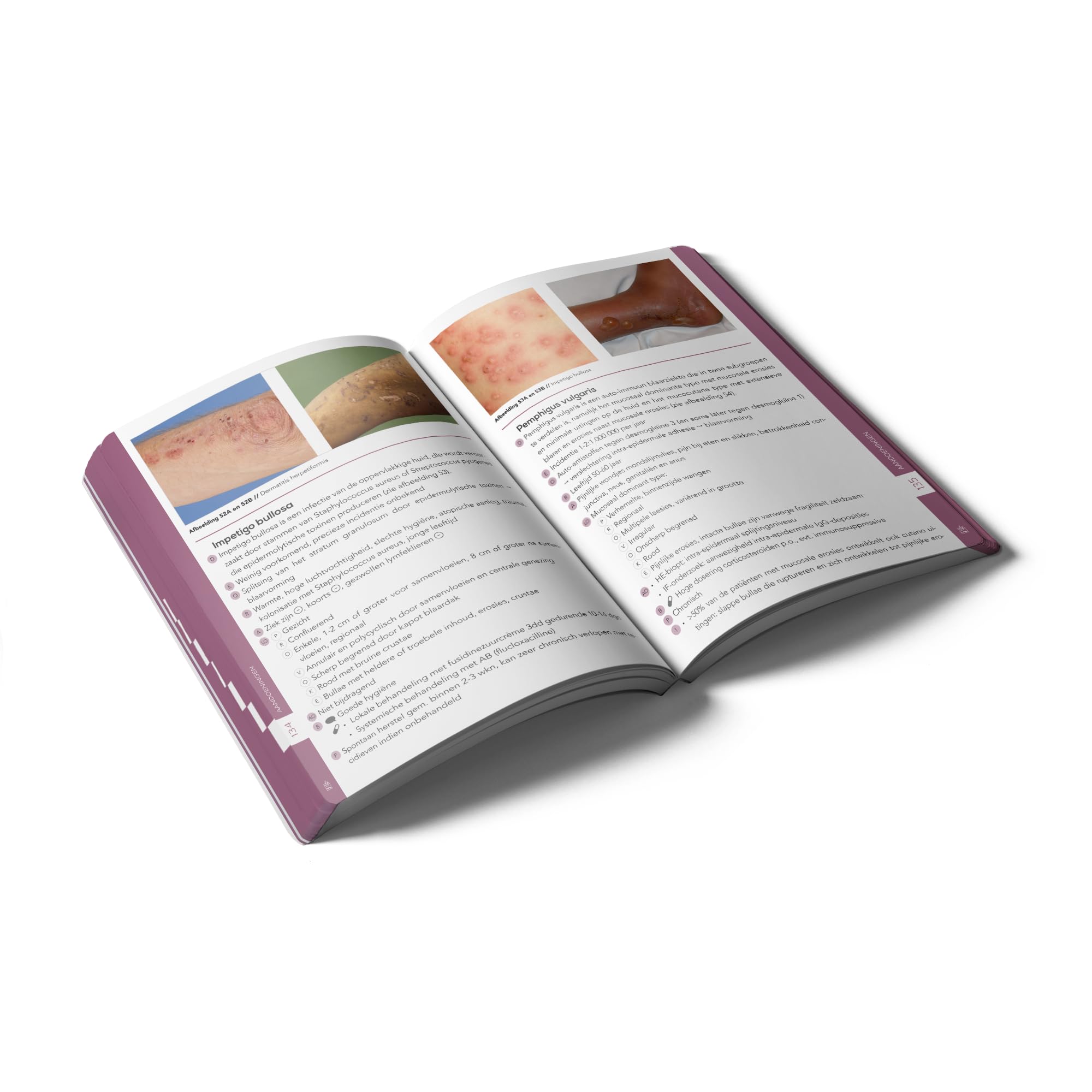 Pocket Dermatology: An essential pocket-sized book on Dermatology.