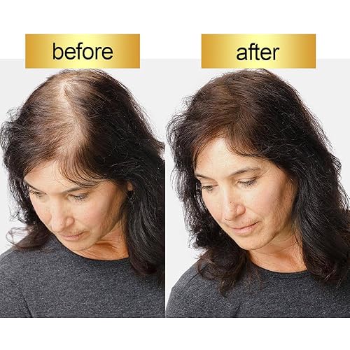 Miniatura 7 de Evofy Recarga de fibra capilar, para cabello fino y puntos calvos, fibras de construcción del cabello, natural e indetectable, cabello más grueso al