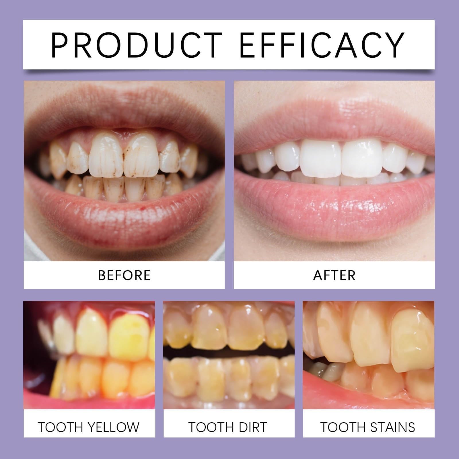 Pasta de dientes Bee Venom con veneno de abeja, pasta de dientes blanqueadora, blanqueamiento dental natural, elimina la decoloración y refresca el aliento, ingredientes naturales para hombres y