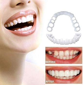 臨時歯の修復パッチ パッチ義歯 義歯 義歯カバー マウスピース 4個 Amazon.co.jp: 4対のパッチ付き義歯-義歯の頂部と底部の臨時義歯-男性