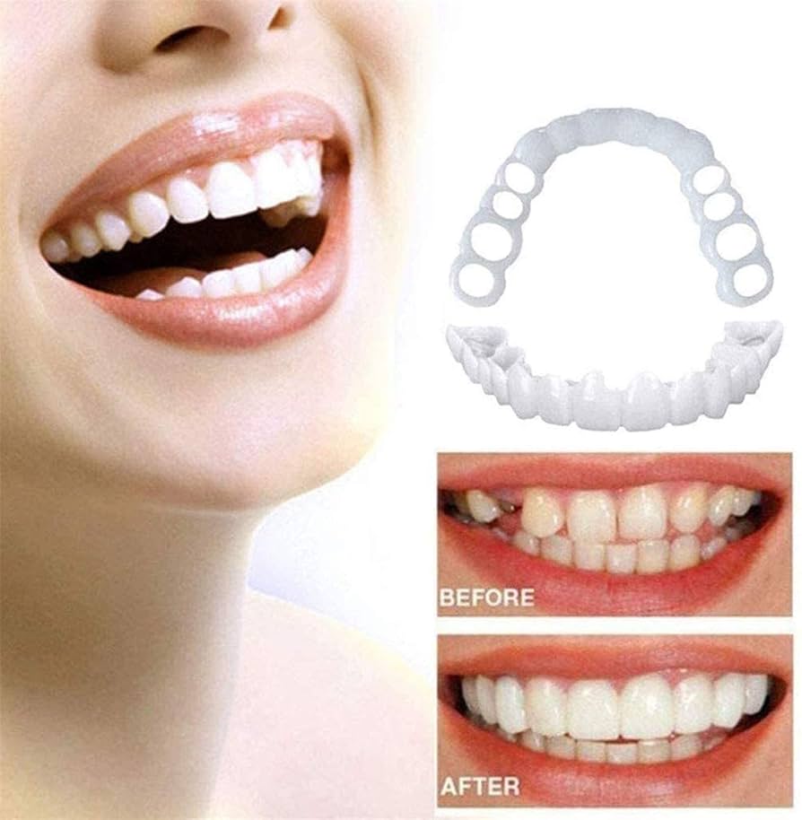 臨時歯の修復パッチ パッチ義歯 義歯 義歯カバー マウスピース 4個 Amazon.co.jp: 4対のパッチ付き義歯-義歯の頂部と底部の臨時義歯