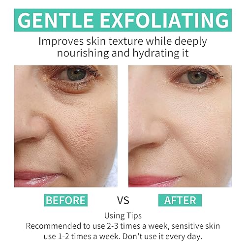 Miniatura 4 de Almohadillas de ácido glicólico al 35% para cara y cuerpo + máscara de arcilla de fresa para cara, mascarilla facial de arcilla rosa, cuidado de la