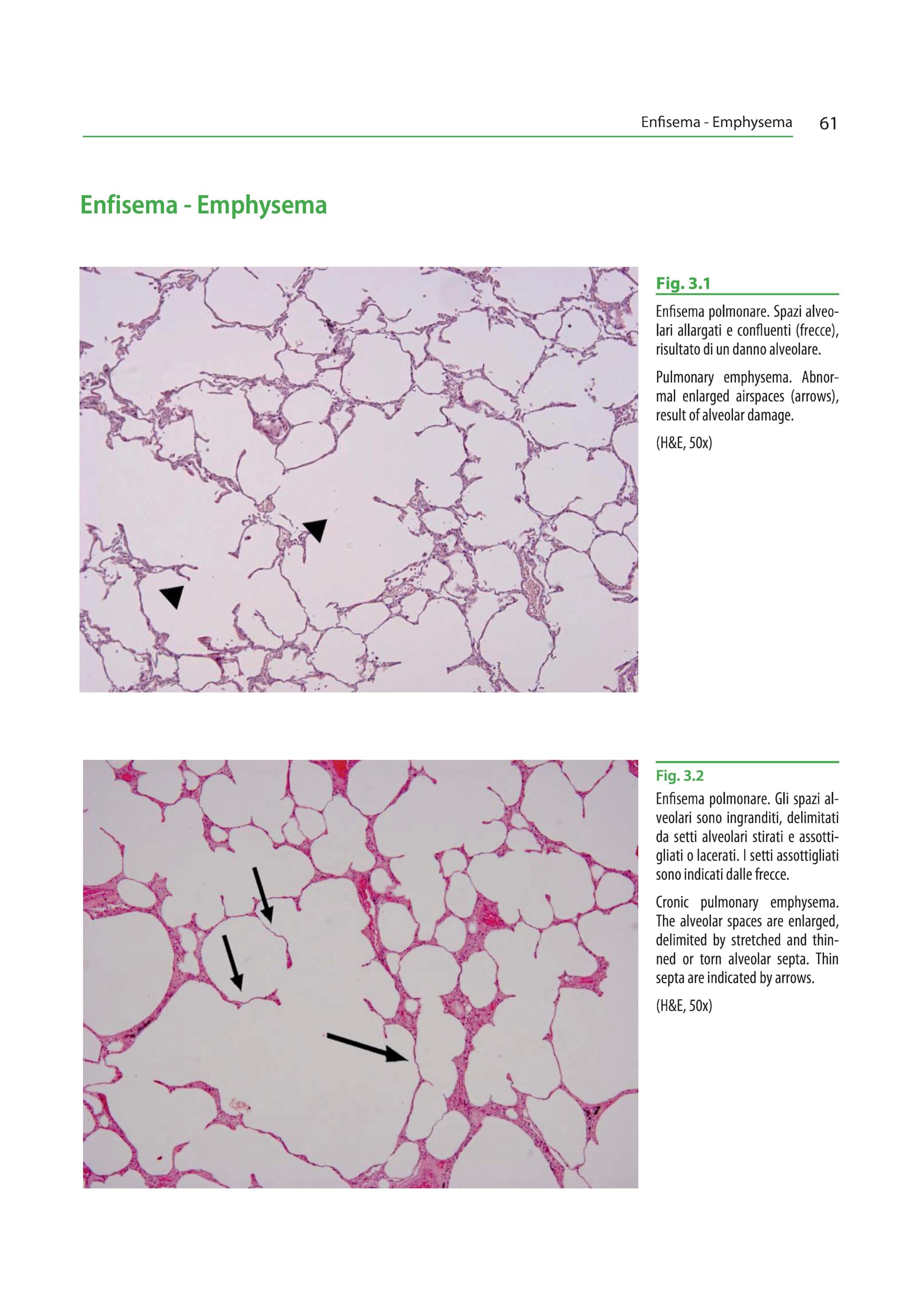 Atlante di istopatologia forense-Atlas of forensic histopathology. Ediz. bilingue