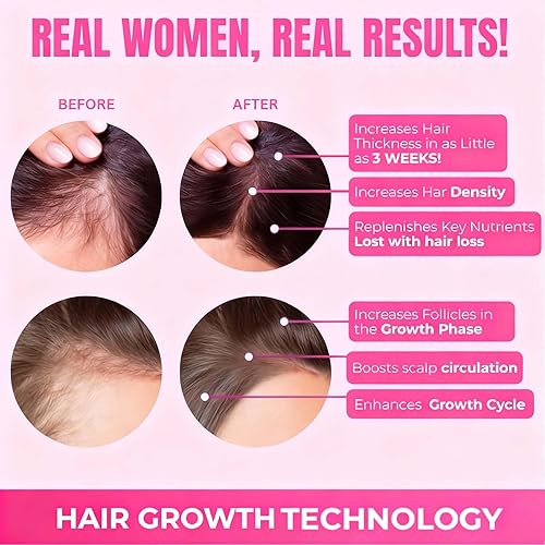 Miniatura 3 de Serlyn Vitaminas para el crecimiento del cabello  Fórmula botánica de apoyo capilar para un cabello más grueso y de aspecto más completo  Nutre las