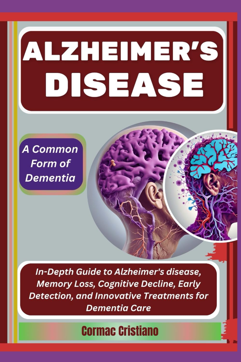 ALZHEIMER'S DISEASE: A Common Form of Dementia: In-Depth Guide to Alzheimer's disease, Memory Loss, Cognitive Decline, Early Detection, and Innovative Treatments for Dementia Care