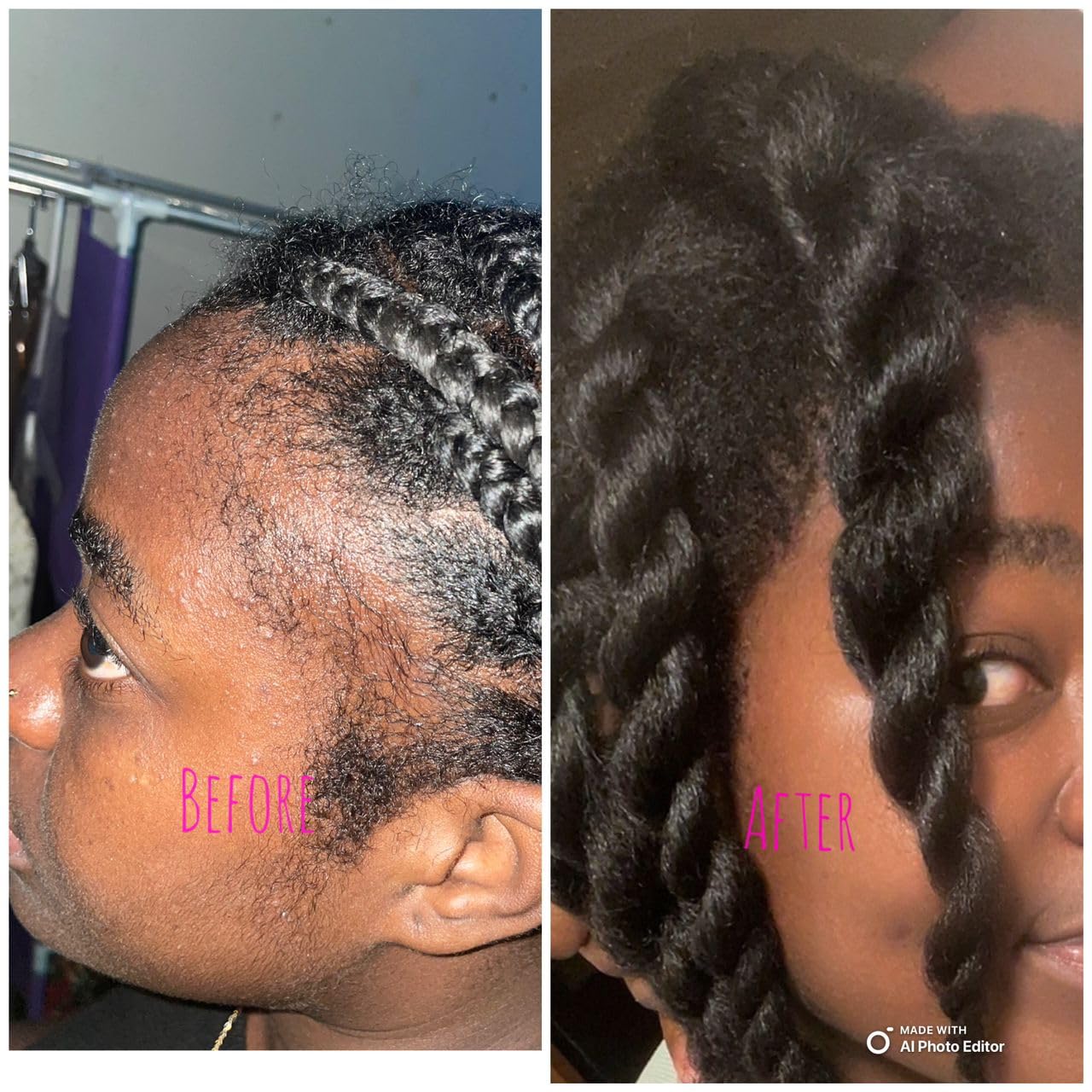 Miracle Hair Growth Oil for Thick Hair, Coconut Scent, Unisex-Adults