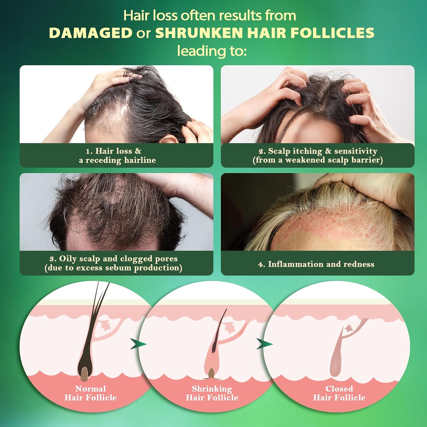 Hair Growth Serum Roll-On: Advanced Scalp Stimulator with 16 Botanical Extracts Veganic Natural Hair Growth Oil for Thicker Fuller Hair