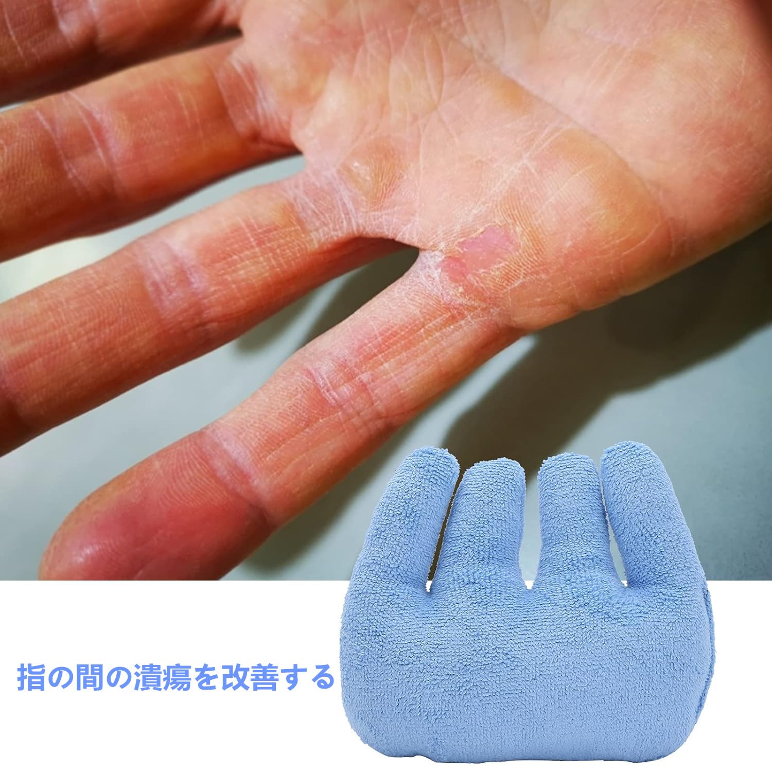 DEEYOTA 指拘縮クッション グリップクッショ 指拘縮 指セパレーター 弾性バンド 高齢者拘縮スキン内訳 グラブバー 拘縮のための手指補助 リハビリ訓練具・自助具