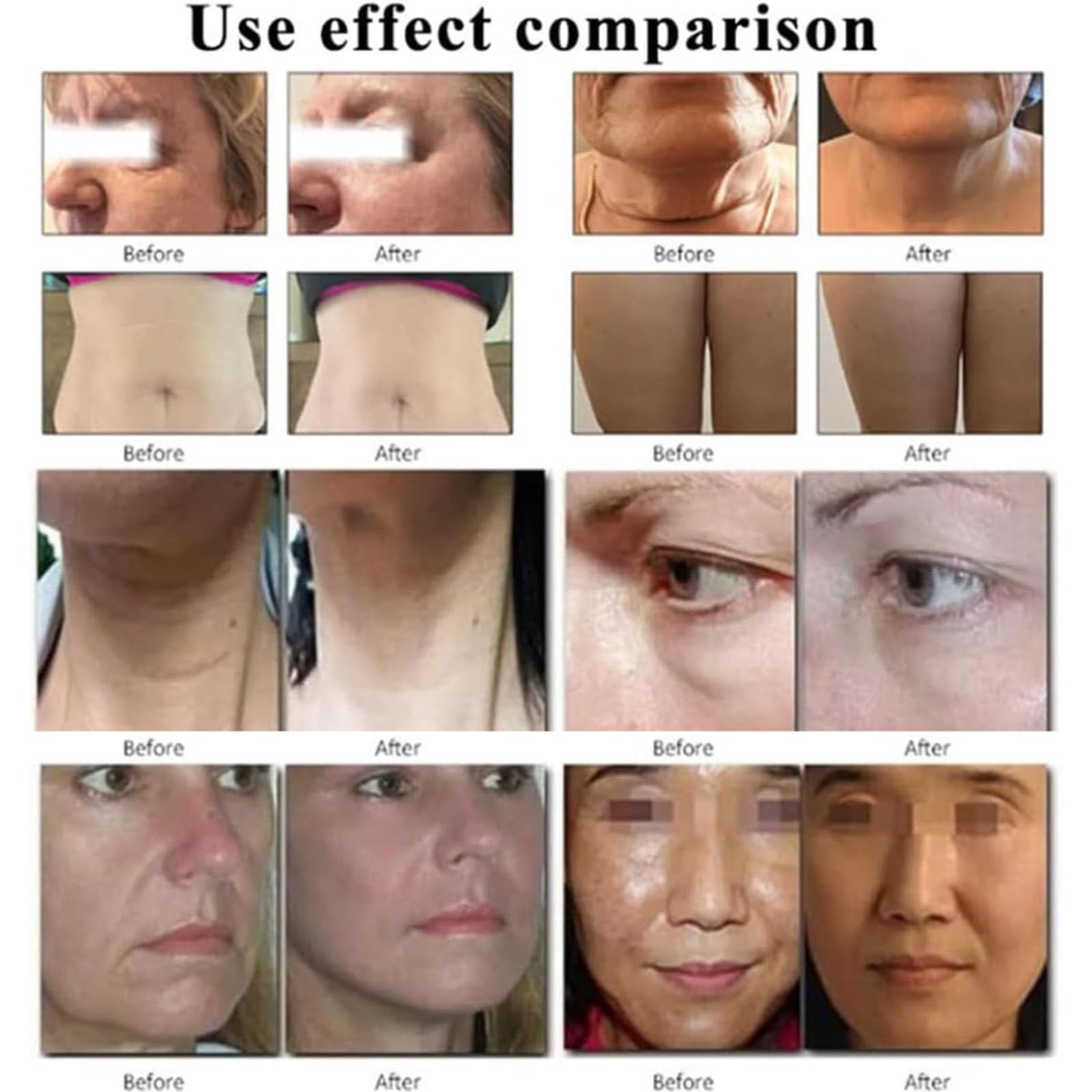 3D HIFU Anti Wrinkle Face Lift Skin Tightening Beauty Machine, Skin Tighting Body Slimming Machine bezpieczną i bezbolesną dla przeciwzmarszczkowych,5head