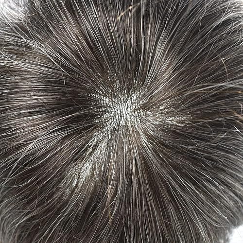 Miniatura 10 de Sistema de pelo de la PU para hombre Toupee Real Cabello Humano Pieza Toupee Sistema de Reemplazo de Cabello Hombres Hairpieces Protesis Capilar