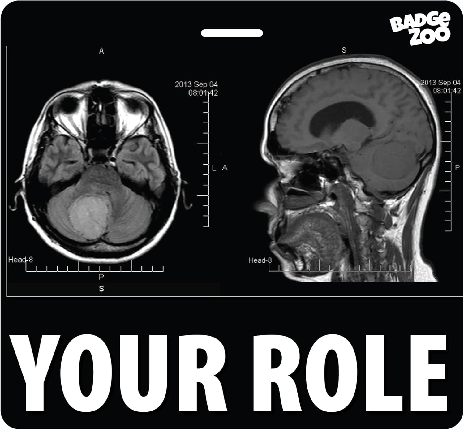 Personalized Double-Sided Horizontal Radiology Marker Holder with MRI Scans - Waterproof PVC - 3 1/3" x 3 1/8" - 100 Pack