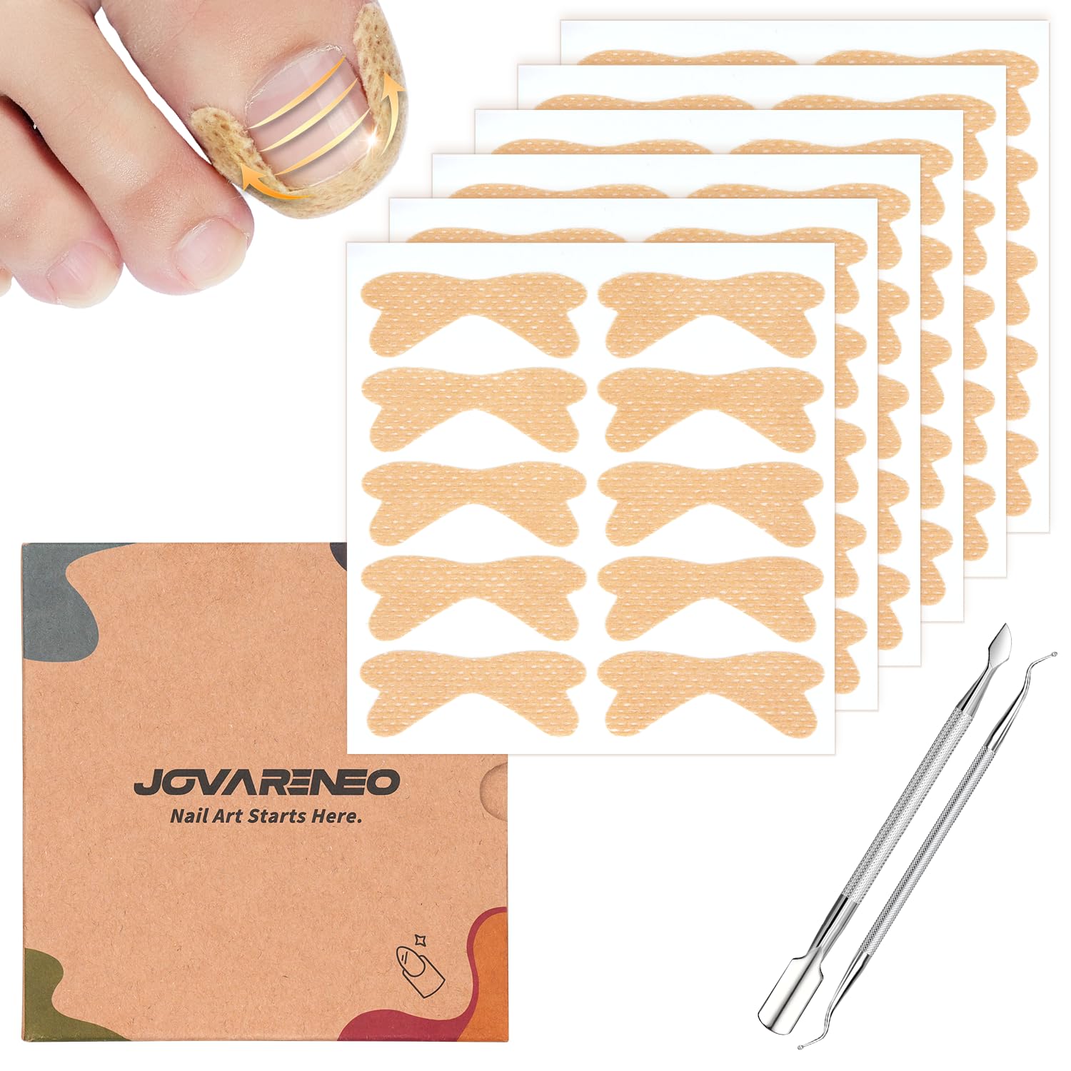 Ingrown Toenail Treatment, Breathable Curved Toenail Corrector Skin Color