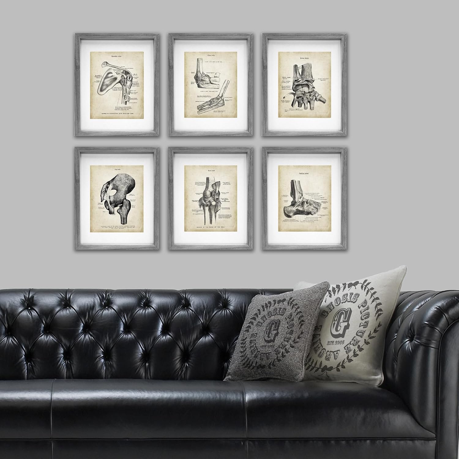 Medical Decor set of 6 unframed Orthopedic Posters of Human Anatomy Joints Wall Decor Gift for Orthopedic Surgeon, Physical Therapist, Chiropractor, Orthopedic Doctor Office Wall Art.