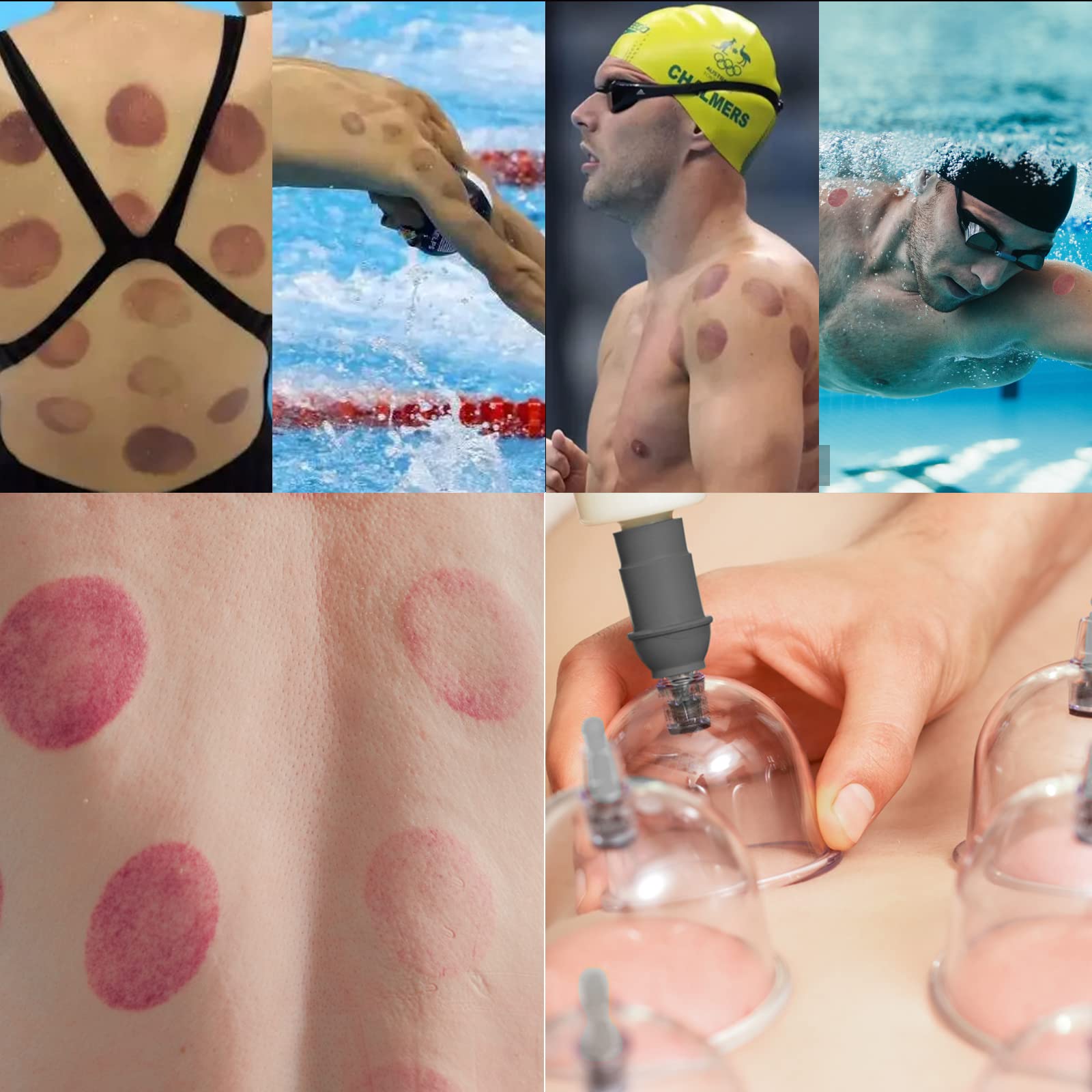Schröpfgläser mit Vakuumpumpe - Schröpfglas - Hochwertig Schröpfen (18 Stück) - Schröpfgläser Gesicht und für den ganzen Körper - Schröpfset -Cupping set