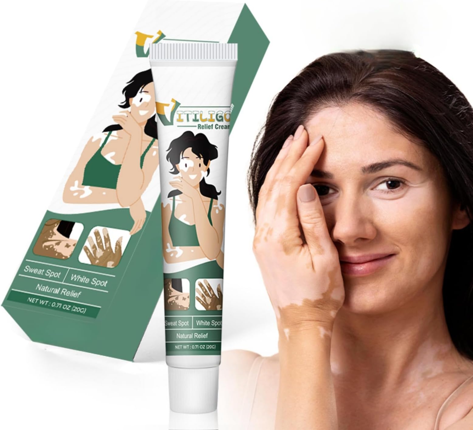 Vitiligo Relief Cream 20g - Effective Treatment for Vitiligo, Tinea Versicolor, & Hypopigmentation, Skin Care Ointment for Reducing White Patches, Herbal Formula for Skin Restoration