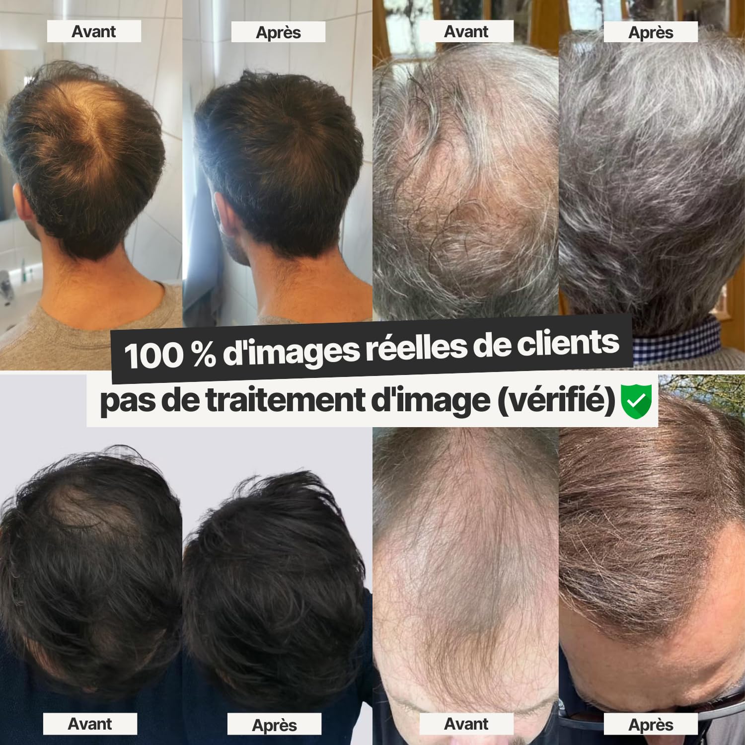 IMPERIO Fibre Capillaire Pour Épaissir les Cheveux & Cheveux Volumineux en Secondes. Poudre Densifiante Cheveux pour un Look Authentique. 100% Naturel! Qualité Salon - 26g (brun foncé)