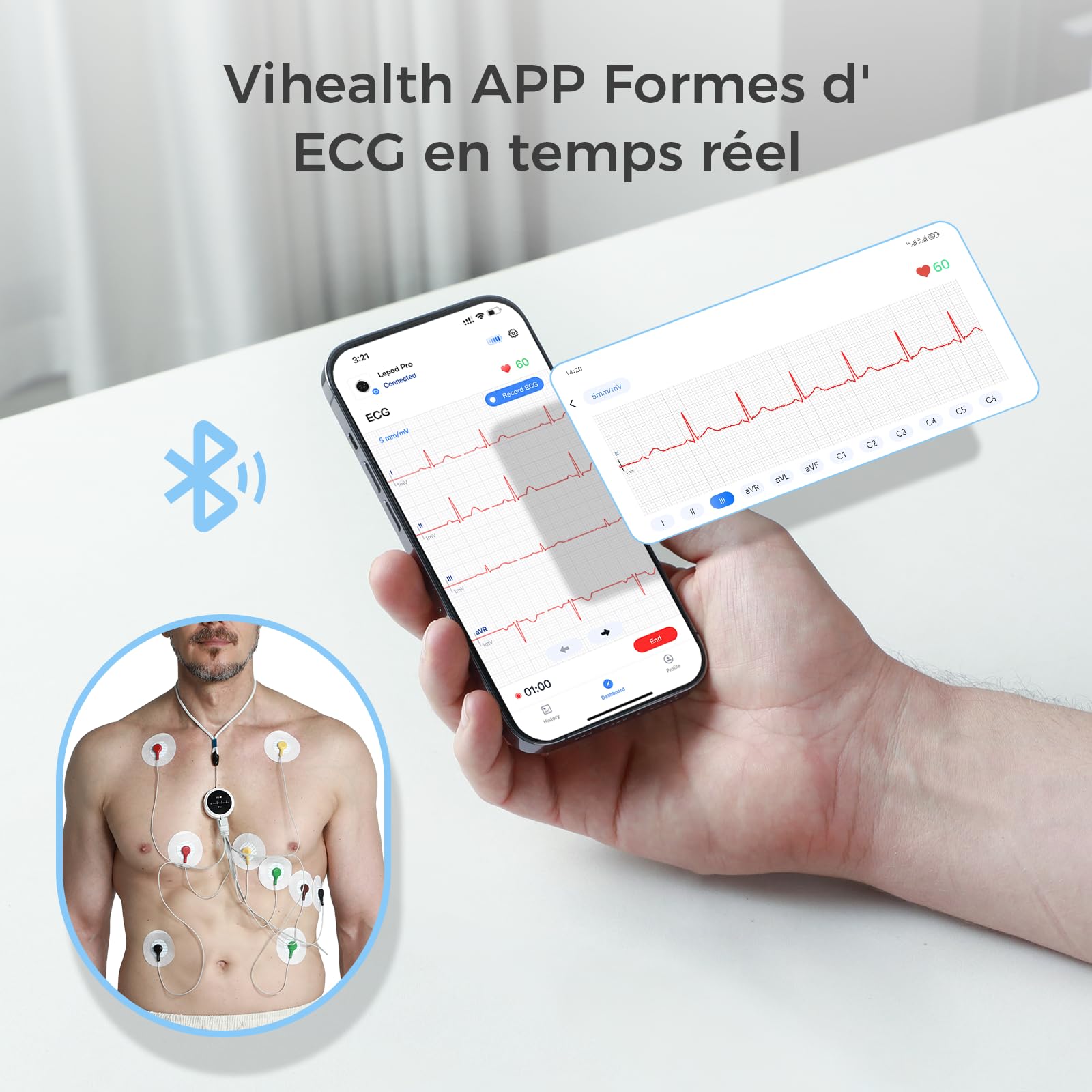 Wellue LP12 ECG portable 12 dérivations avec écran OLED, enregistrement de l'ECG en temps réel sur 24 heures, rapports AI ECG détaillés, marqueurs d'événements, Support pour Smartphone APP et PC