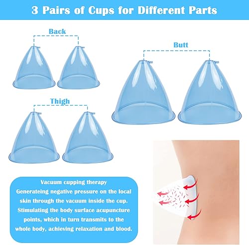 Miniatura 3 de Máquina de terapia al vacío, juegos de terapia de ventosas, masajeador multifuncional de raspado de ventosas, máquina de masaje con forma de cuerpo