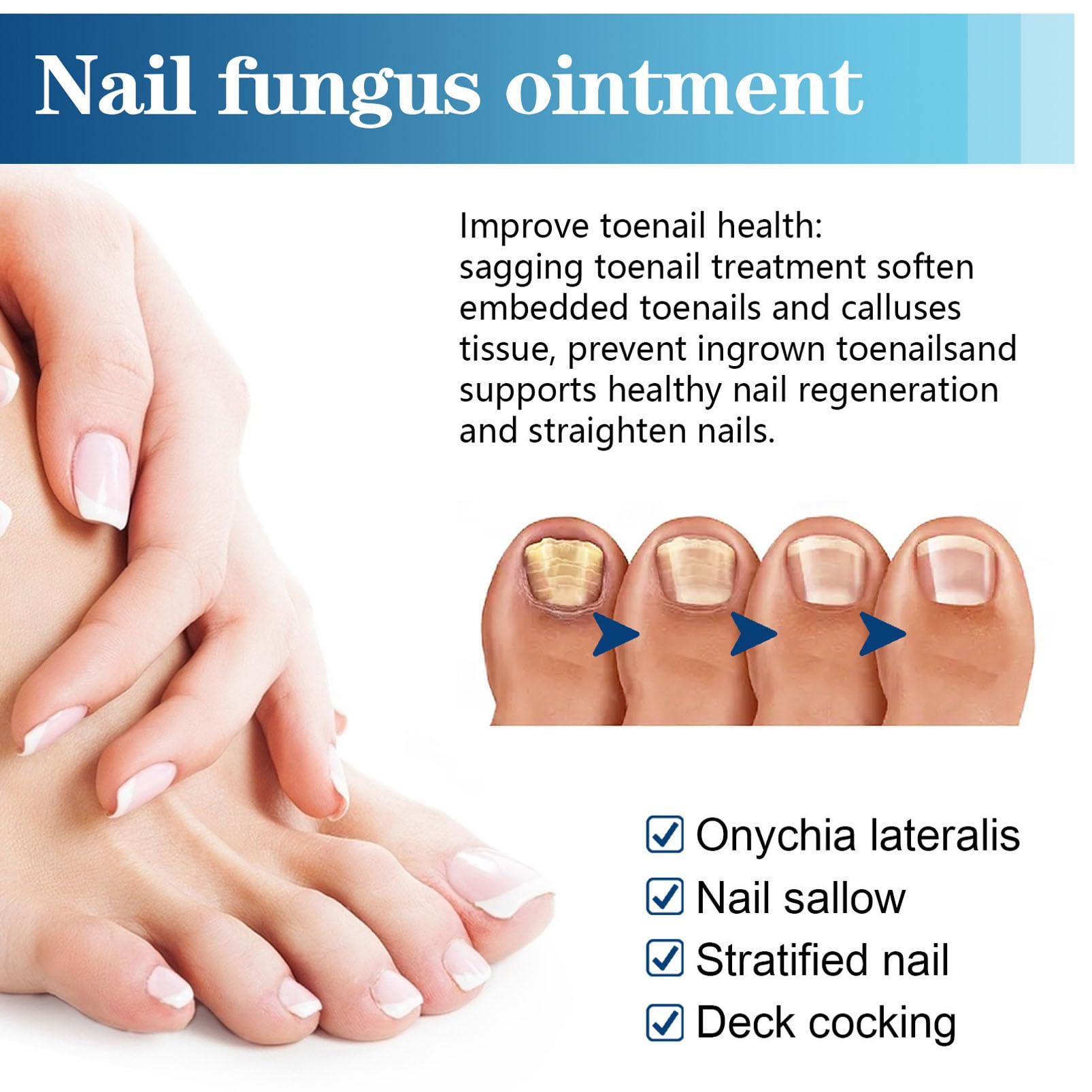 Fungal Nail Treatment Pens for Toenails and Fingernails, 4Pcs Nail Care Fungus Treatment, Anti Fungal Nail Treatment Pens, Toe Nail Fungal Nail Repair Essence, Anti Fungus Nail Strengthener - Image 3