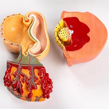 Medical Embryonic Development Model,Egg Fertilization Development Process Model ,12 Parts Anatomy Fertilization Process Model Medical Teaching Tool.