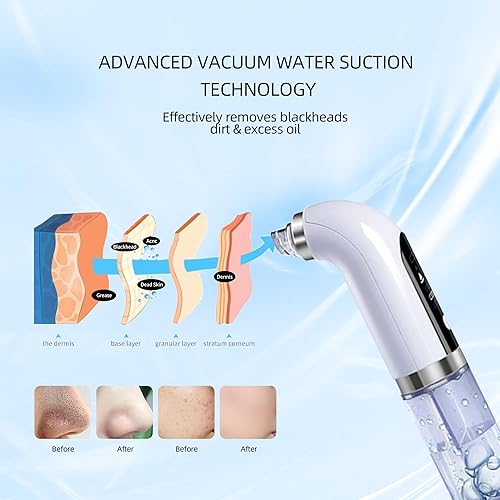 Miniatura 3 de Aspiradora eléctrica para eliminar puntos negros, herramienta facial de limpieza profunda para piel grasa y propensa al acné, recargable por USB,