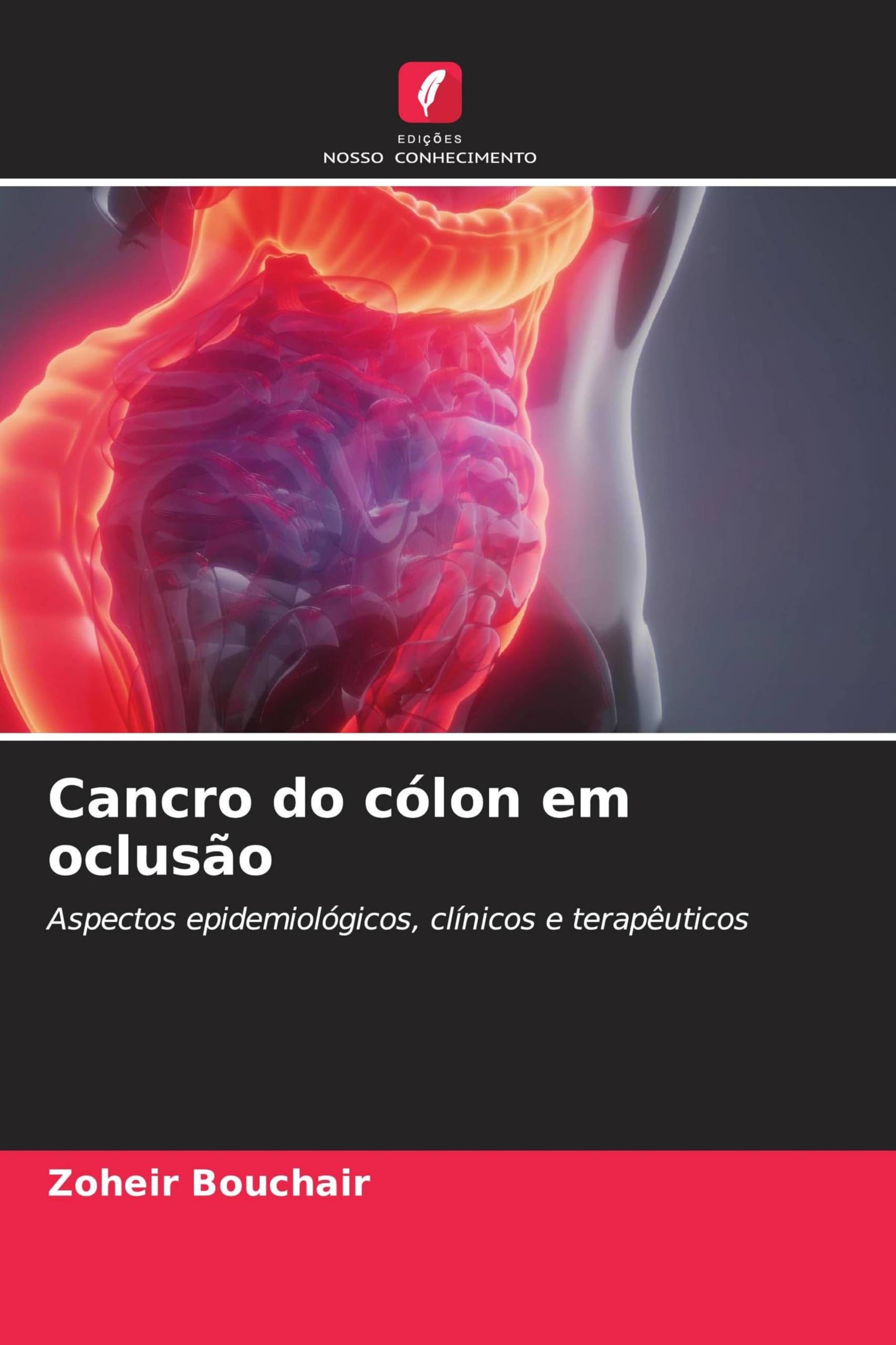 Cancro do cólon em oclusão: Aspectos epidemiológicos, clínicos e terapêuticos