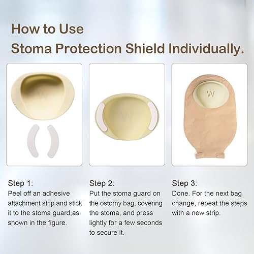 Vista 4 de Stoma Guard and 50 Pairs of Stickers Ultimate Protection for Your Ostomy Bag