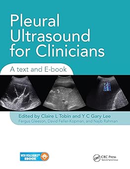 PLEURAL ULTRASOUND FOR CLINICIANS A TEXT AND E BOOK (PB 2020)