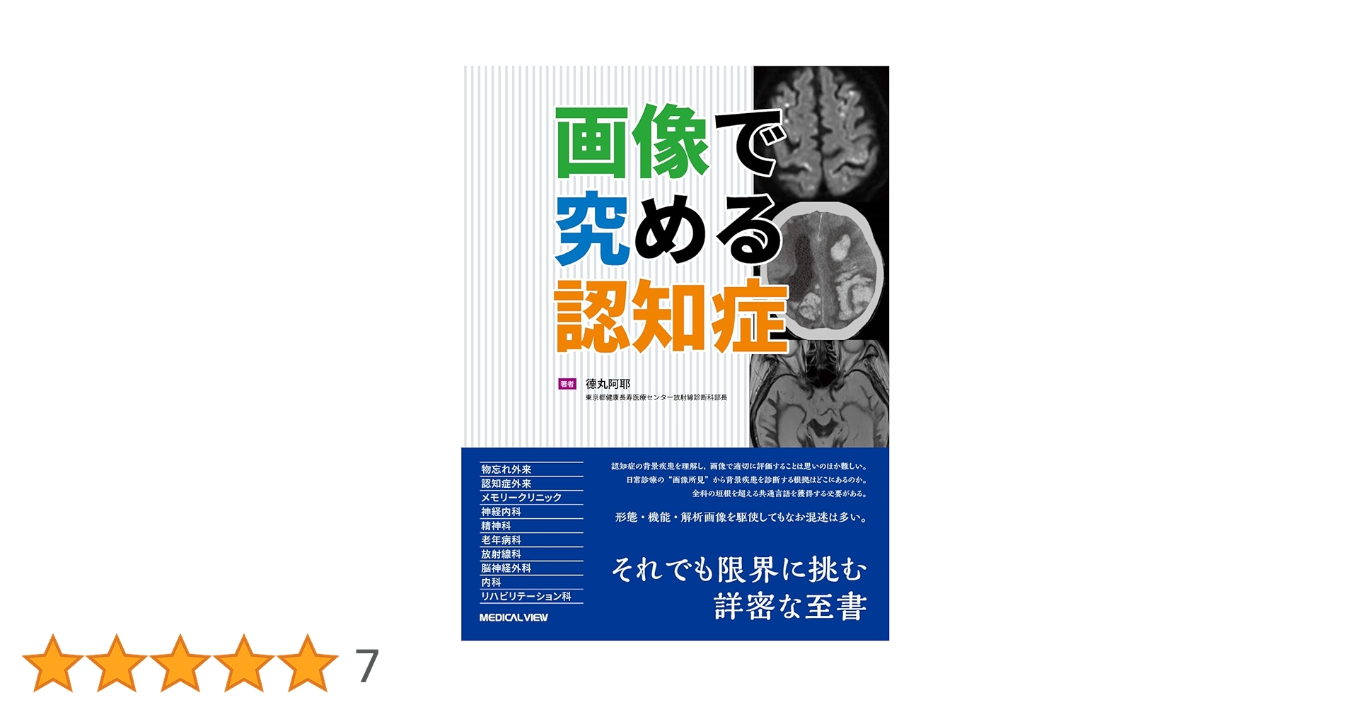 画像で究める認知症 | 德丸 阿耶 |本 | 通販 | Amazon