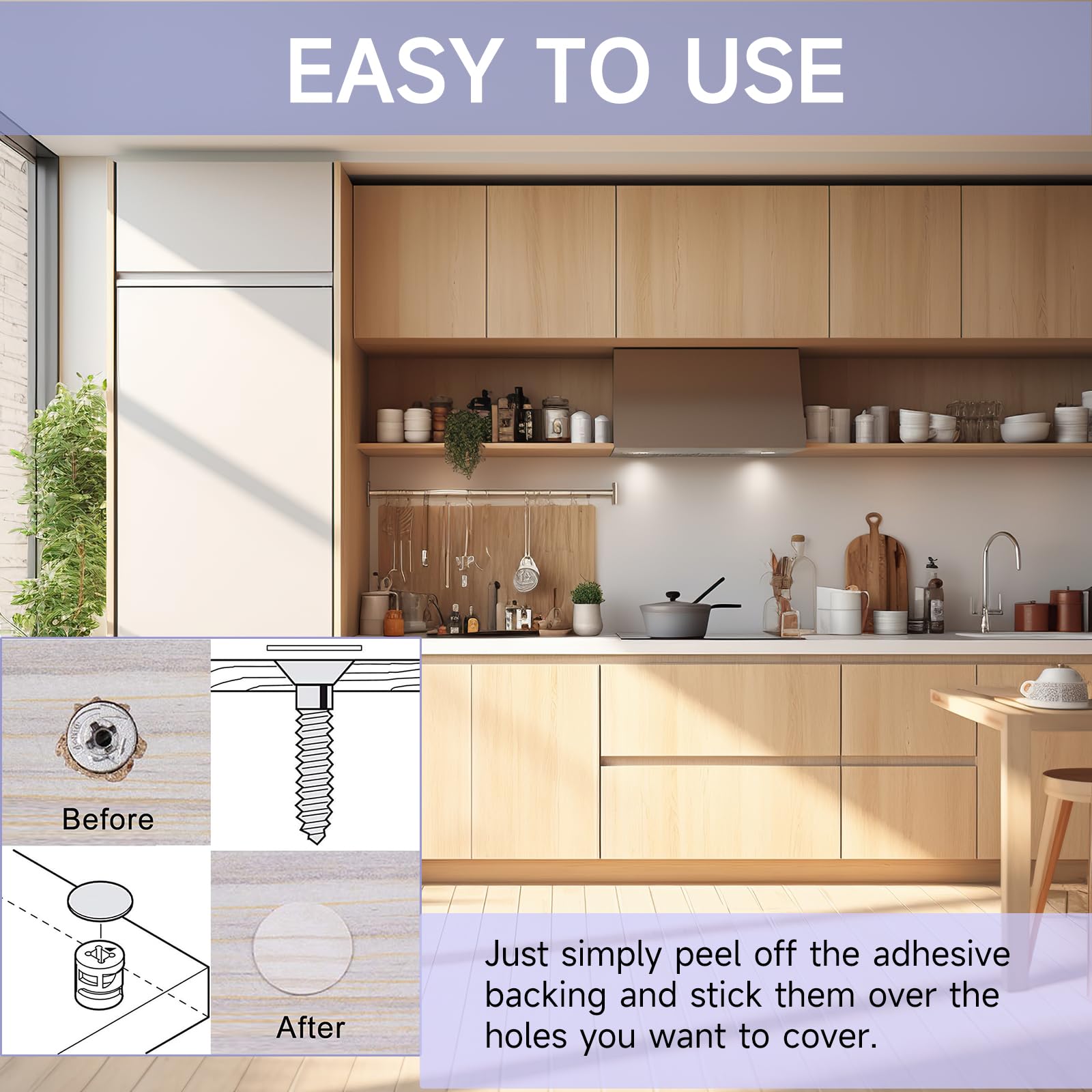 Kit Fraises Polissage Composite Dentaire AZDENT - Caoutchouc/silicone, Diam. Tige 2.35mm RA