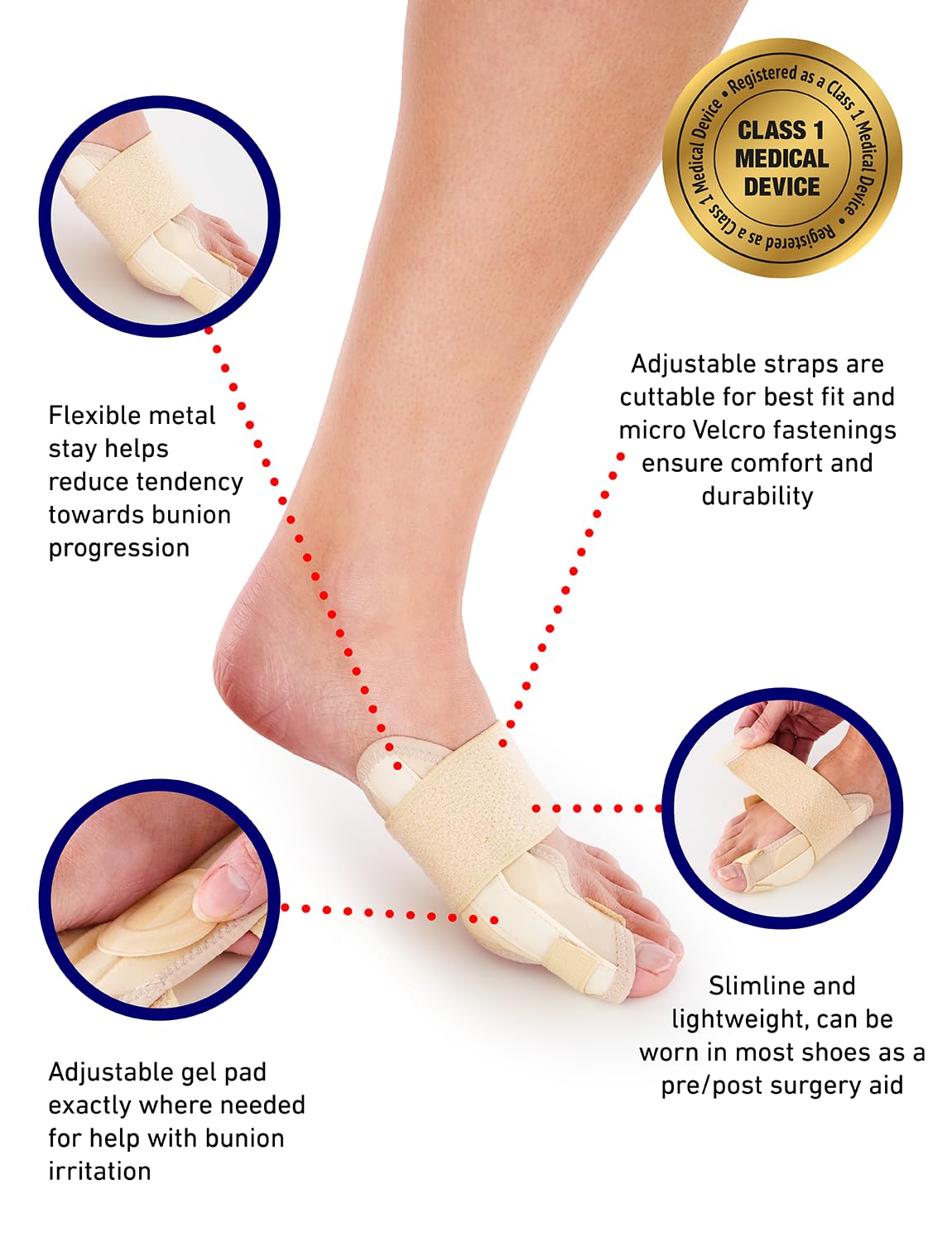 Neo-G Supporto sottile per alluce valgo con supporto flessibile e cuscinetto in gel regolabile, per uso quotidiano, pre post chirurgia, sollievo dal dolore, dispositivo medico di classe 1, destro e