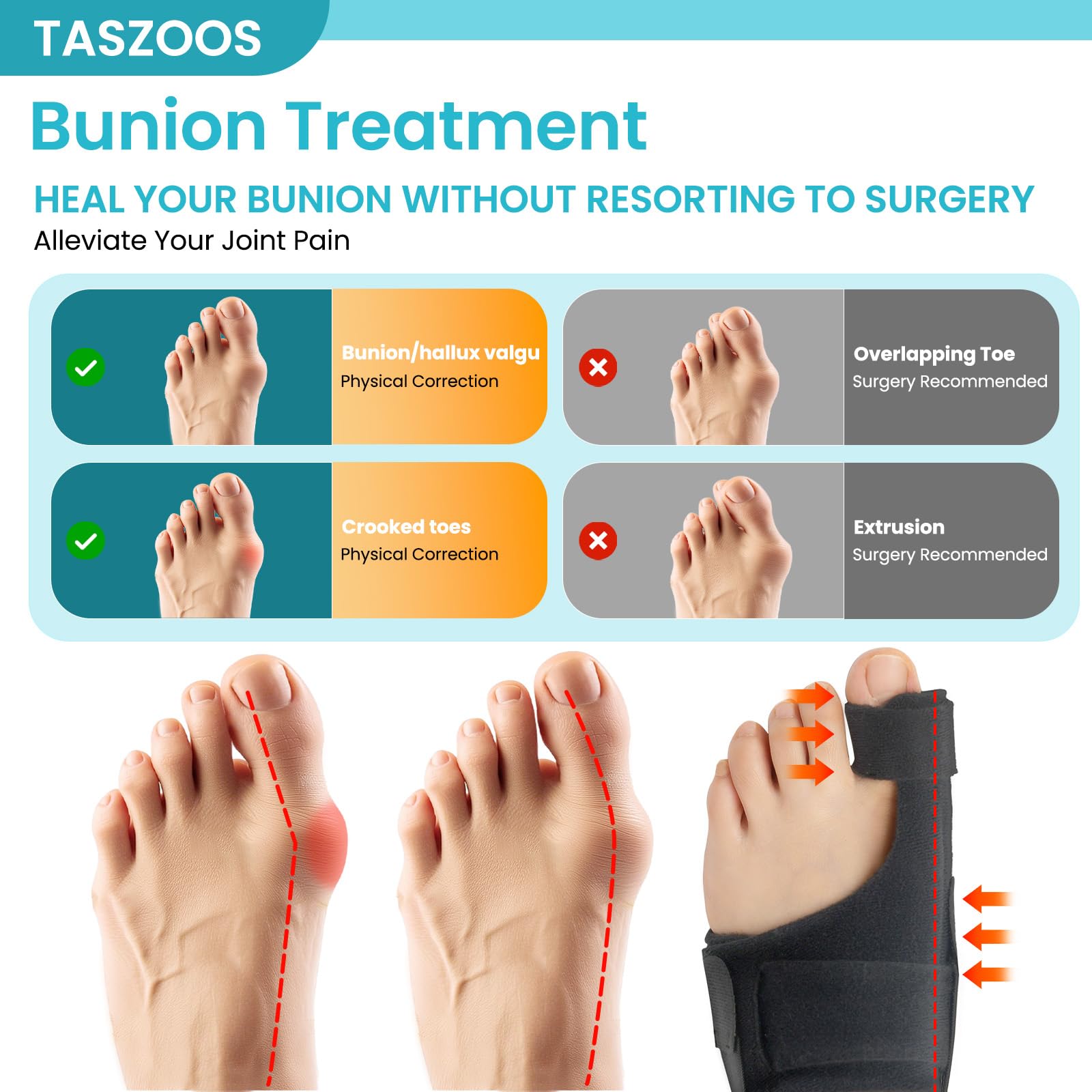 TASZOOS 2-Pack Bunion Corrector for Women & Men, Adjustable Big Toe Straightener for Bunion Relief-Hallux Valgus Pain Relief, Breathable Toe Corrector Brace Day & Night, Washable (Black)