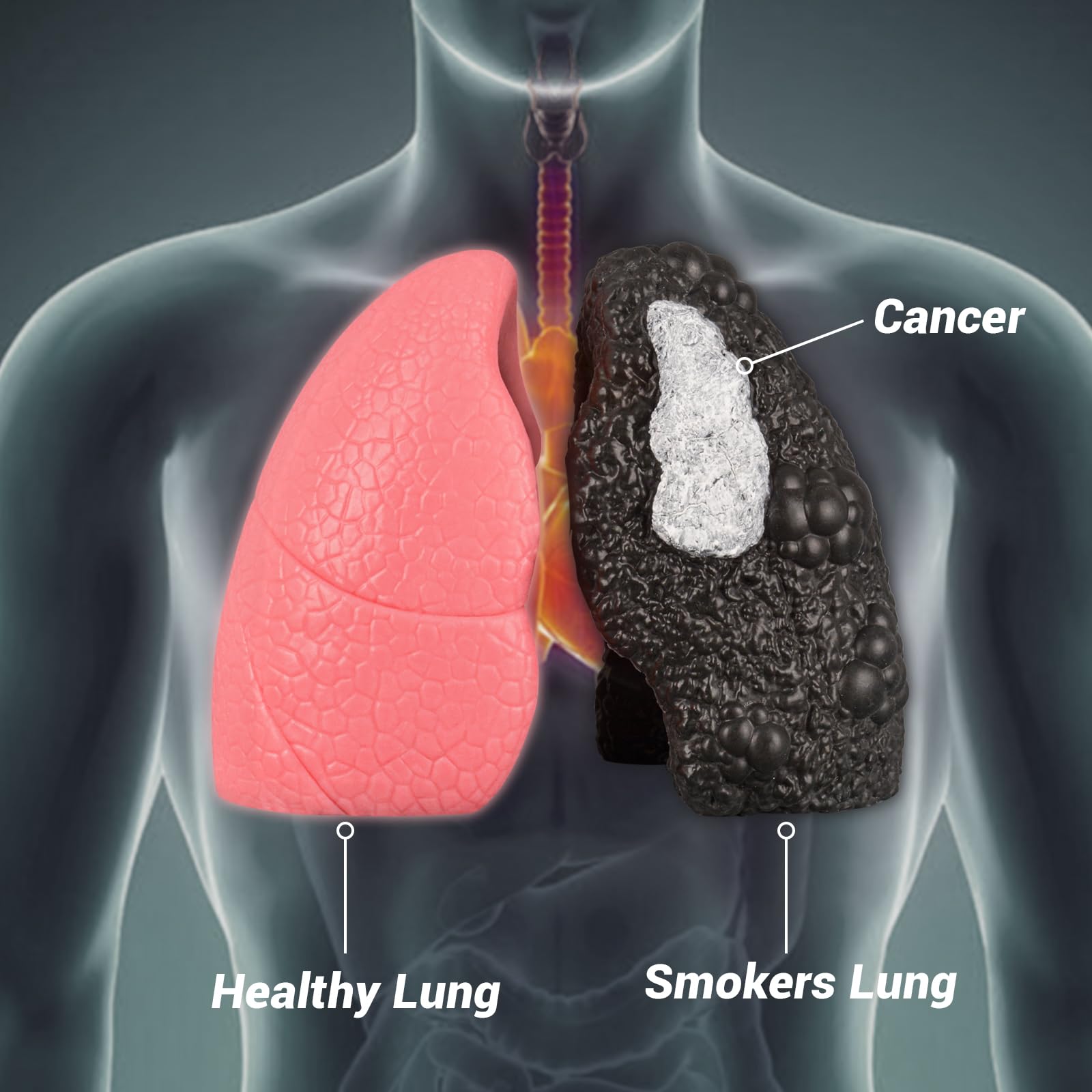 cigarette lungs vs normal Ever Wondered What a Smoker's Lung Looks Like? Postmortem appearances of lungs of
