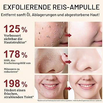 Peel Shot Glow Rice Exfoliating Ampoule Gentle Exfoliating Serum for Face and Body White Rice Capsules for Pore Reduction and Intensive Moisturisation for All Skin Types