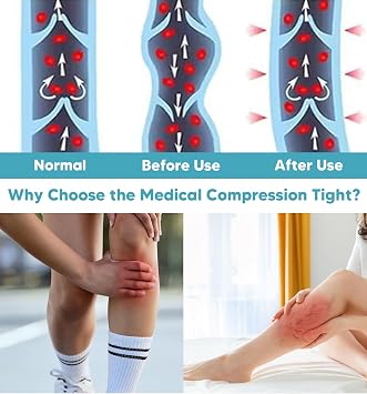 Medical Compression Pantyhose for Women 8-15mmHg, Graduated Support Footless Compression Tight, High Waist Circulation Compression Leggings, Comfort All Days, for Varicose Veins, Leg Pain(Black, M)