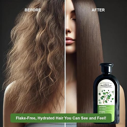 Miniatura 4 de Champú anticaspa de brotes de abedul y aceite de ricino  11.83 onzas líquidas  Fortalece el cabello, hidrata y combate la caspa. Ingredientes