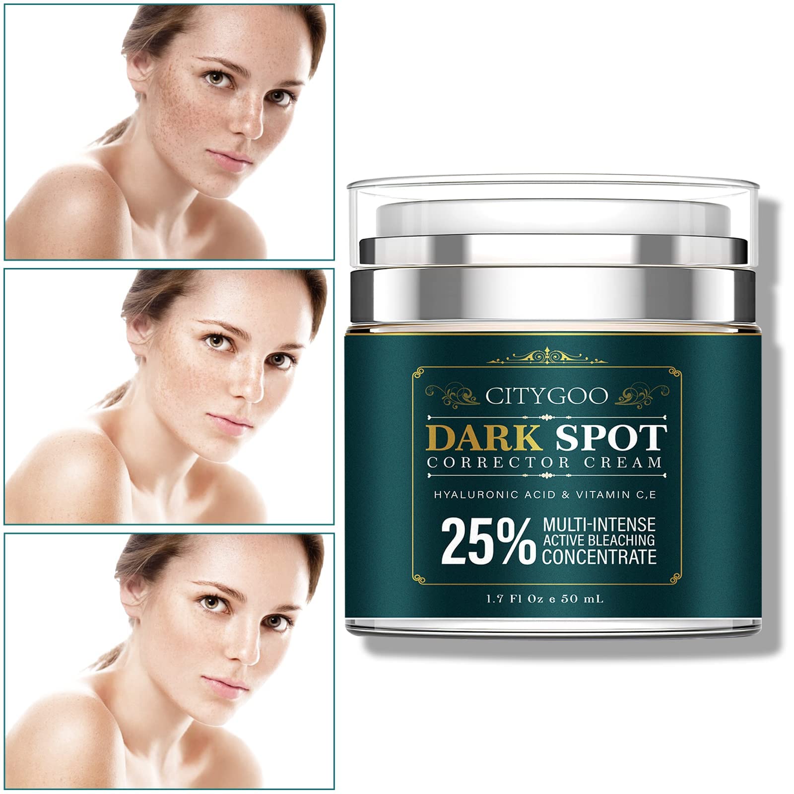 CITYGOO Dark Spot Remover for Face and Body, Dark Spot Corrector Cream