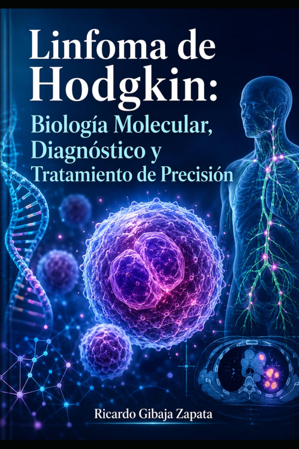 Linfoma de Hodgkin: Biología Molecular, Diagnóstico y Tratamiento de Precisión
