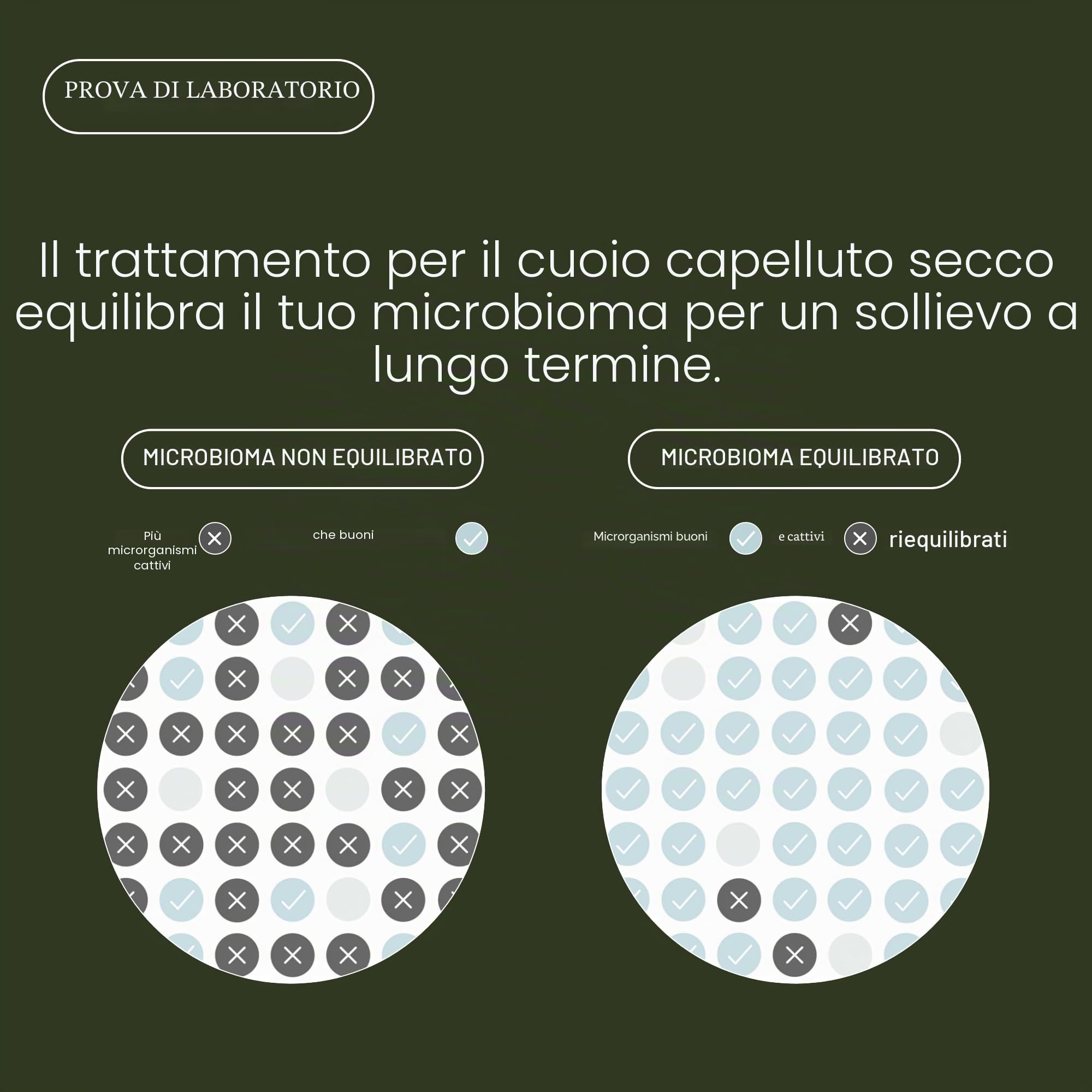 Living Proof Scalp Care Dry Scalp Treatment | Concentrato idratante per il cuoio capelluto secco | Lenisce, allevia la forfora e il prurito | Vegano, senza parabeni, siliconi, solfati | 100ml