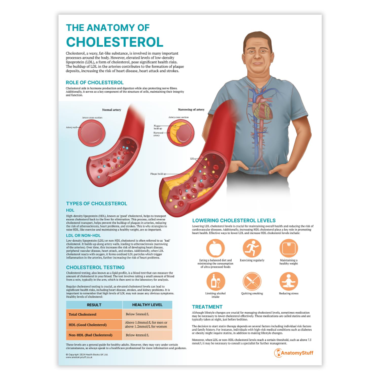 Anatomy Stuff Cholesterol The Anatomy Of Poster, 45X60cm,18X24 Inches, Heart Disease Chart, Lowering Wall Diagram