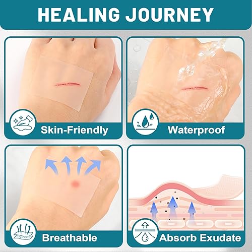 Miniatura 5 de WUYUAN Rollo hidrocoloide para el cuidado de heridas, elegible para HSA FSA, vendajes hidrocoloides con vendajes autoadhesivos, extra grandes de