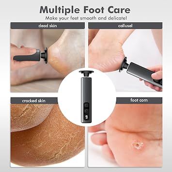 Electric Foot Callus Remover, Callus Remover for Feet with 9 Adjustable Speeds,Rechargeable Pedicure Tool with Replacement Sandpaper Discs for Dead Skin Calluses