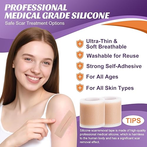 Miniatura 2 de Hojas de silicona para cicatrices de 1.6 x 157 pulgadas (2 rollos a 13.1 ft), cinta de silicona para cicatrices quirúrgicas, tiras de silicona