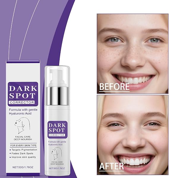 2 x Face Pigment Spot Removal Cream, 50 g Multi Glow Essence, Against Pigment Spots, Melasma and Age Spots, Anti-Sunburn Niacinamide Essence for Men and Women