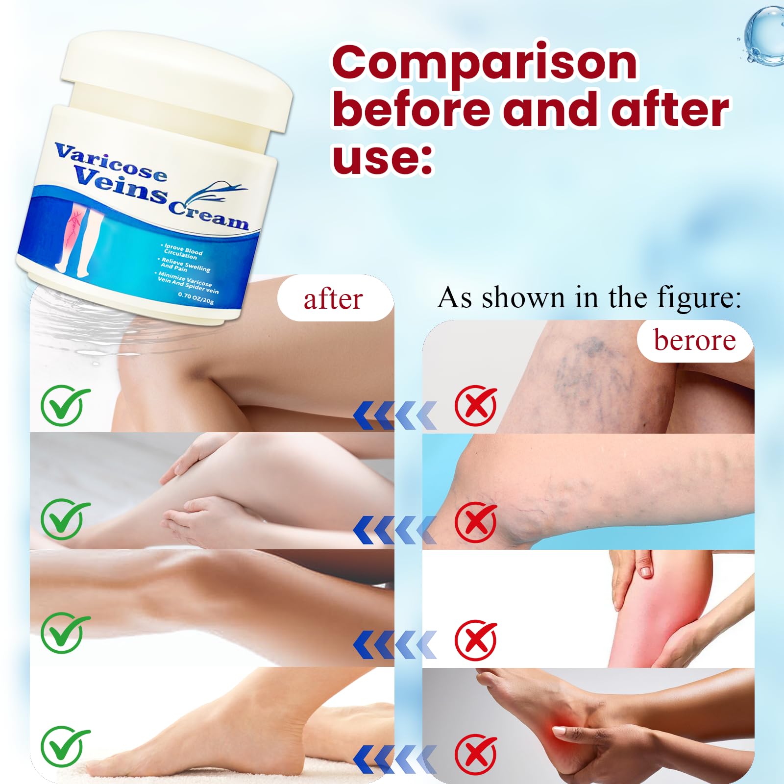 20g Crème pour Les Varices,Soulage Rapidement Les Jambes Fatiguées Et Lourdes,Facile à Utiliser