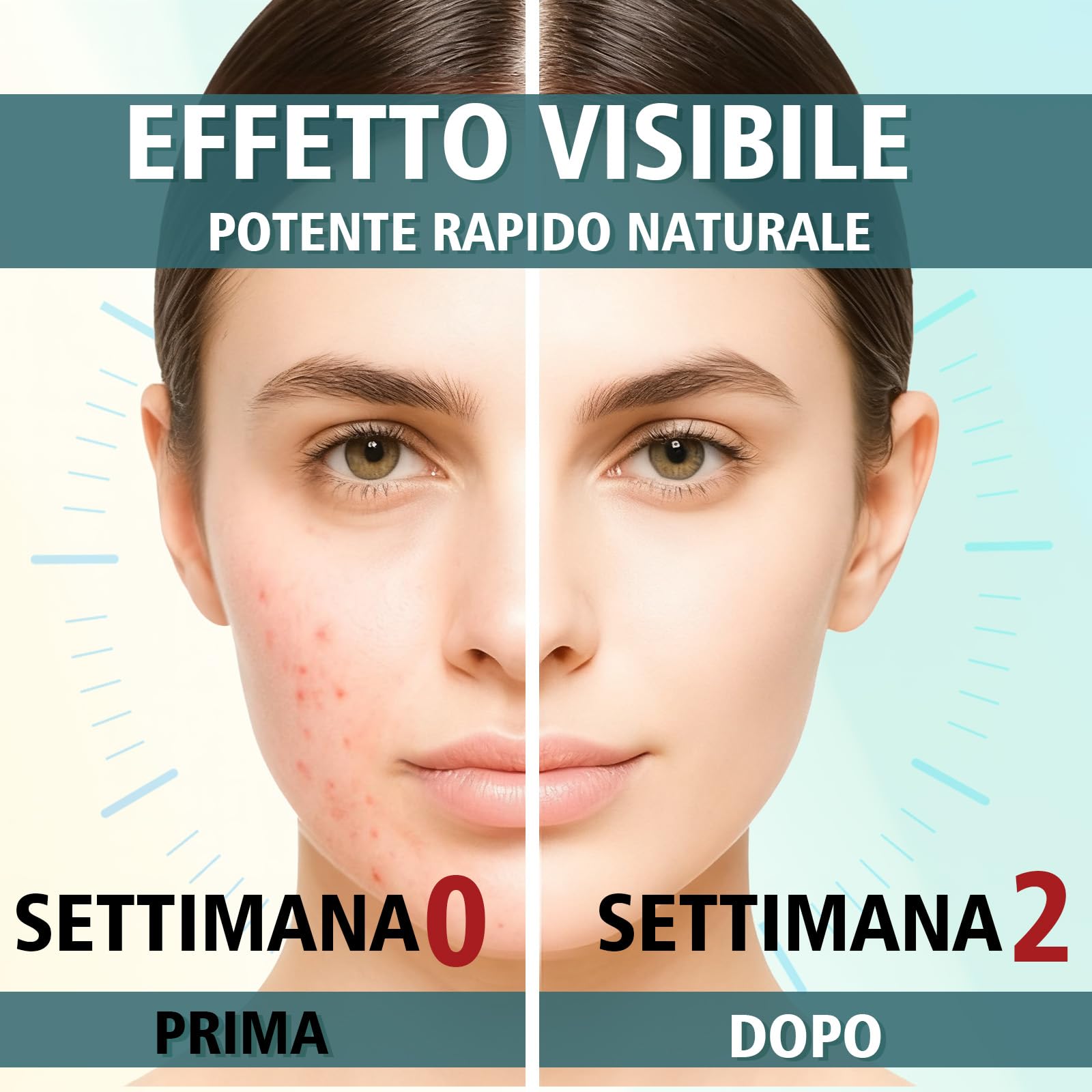 Crema Brufoli Viso, Crema Acne Potentissima, Cura per Brufoli e Imperfezioni, Riduce Subito Acne e Brufoli, Punti Neri e Rossori, Adatta a Tutti i Tipi di Pelle e Età,per la Pelle di Viso e Corpo