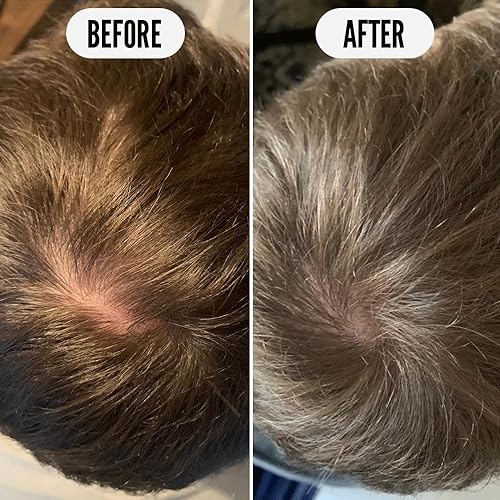 Miniatura 8 de Noughty 97% Natural Get Set Grow Hair Thickening Conditioner, Green Robusta Coffee Granos y Piroctone Olamine para optimizar la salud del cuero