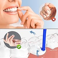 Vista 5 de Herramienta de extracción de alineadores, 5 herramientas de extracción de llaves invisibles, herramienta de extracción de retenedores, adecuada