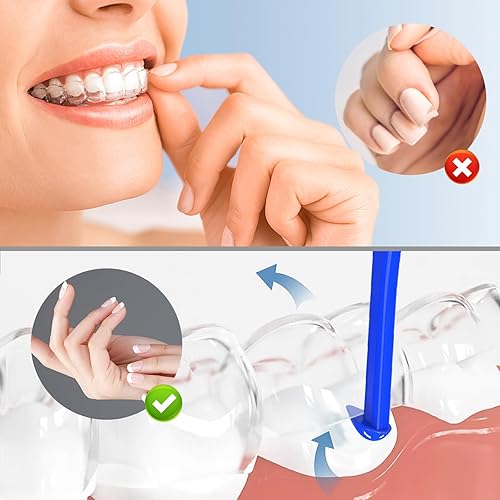Miniatura 5 de Herramienta de extracción de alineador, 10 herramientas de extracción de llaves invisibles, herramienta de extracción de retenedores, adecuada para